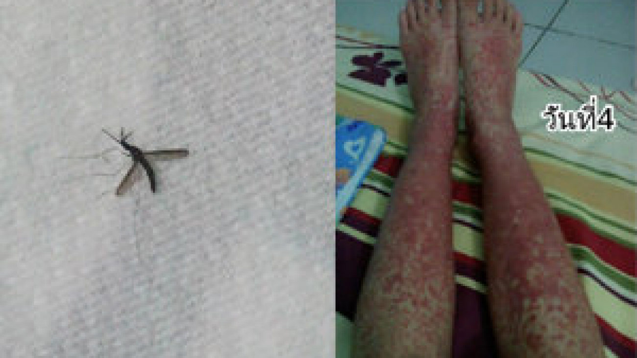 mosquito