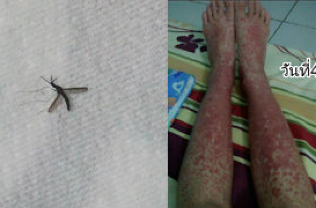 mosquito