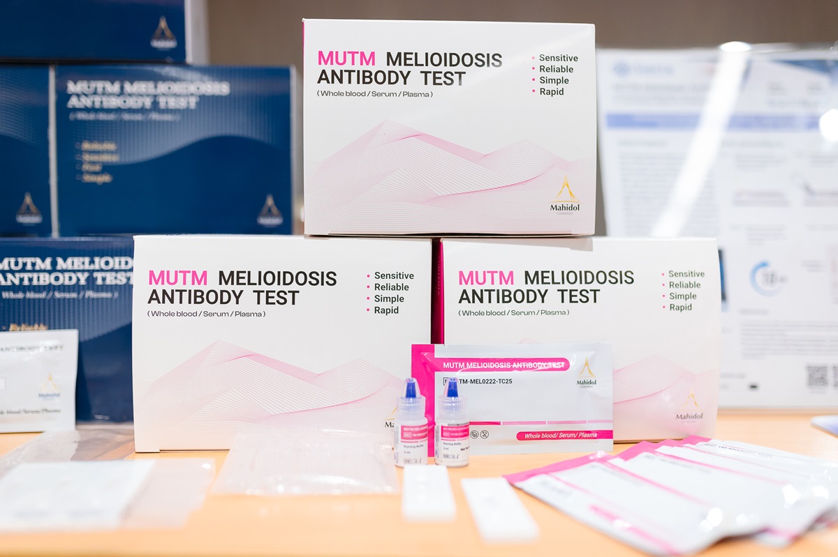 Test Kit – Department of Microbiology and Immunology