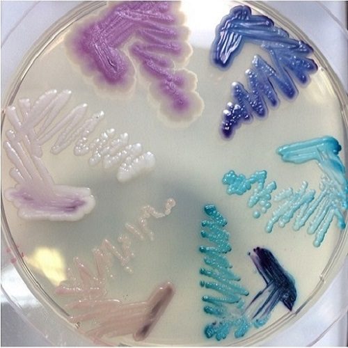 Fungal lab diagnosis-Chrom