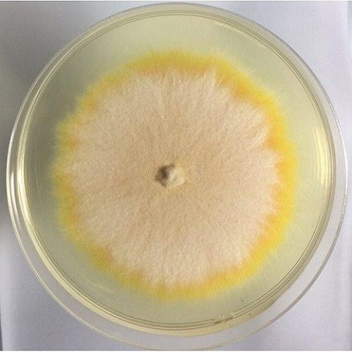 Fungal lab diagnosis-Fungal culture1