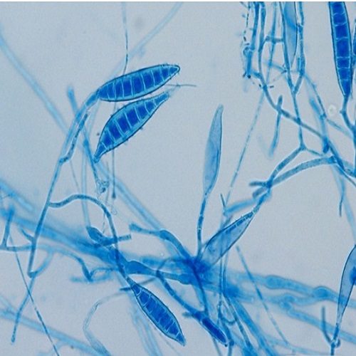 Fungal lab diagnosis-LPCB