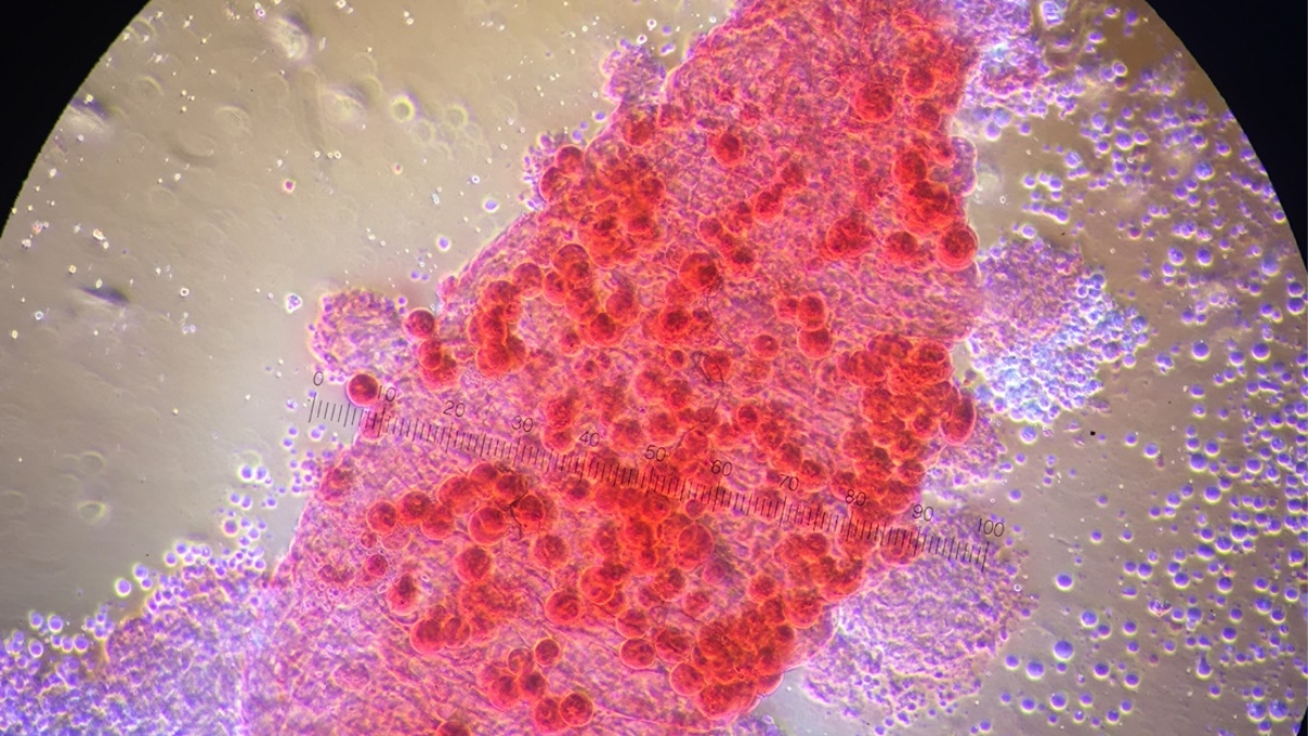 H_Residual Malaria 003-1