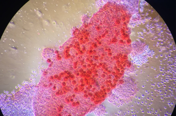H_Residual Malaria 003-1