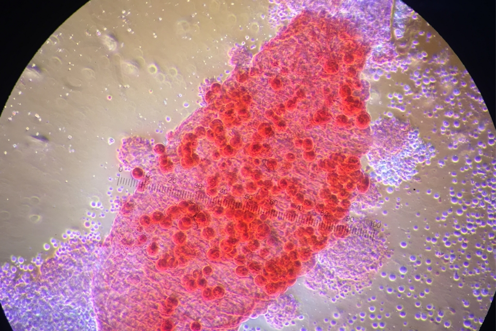 H_Residual-Malaria-003