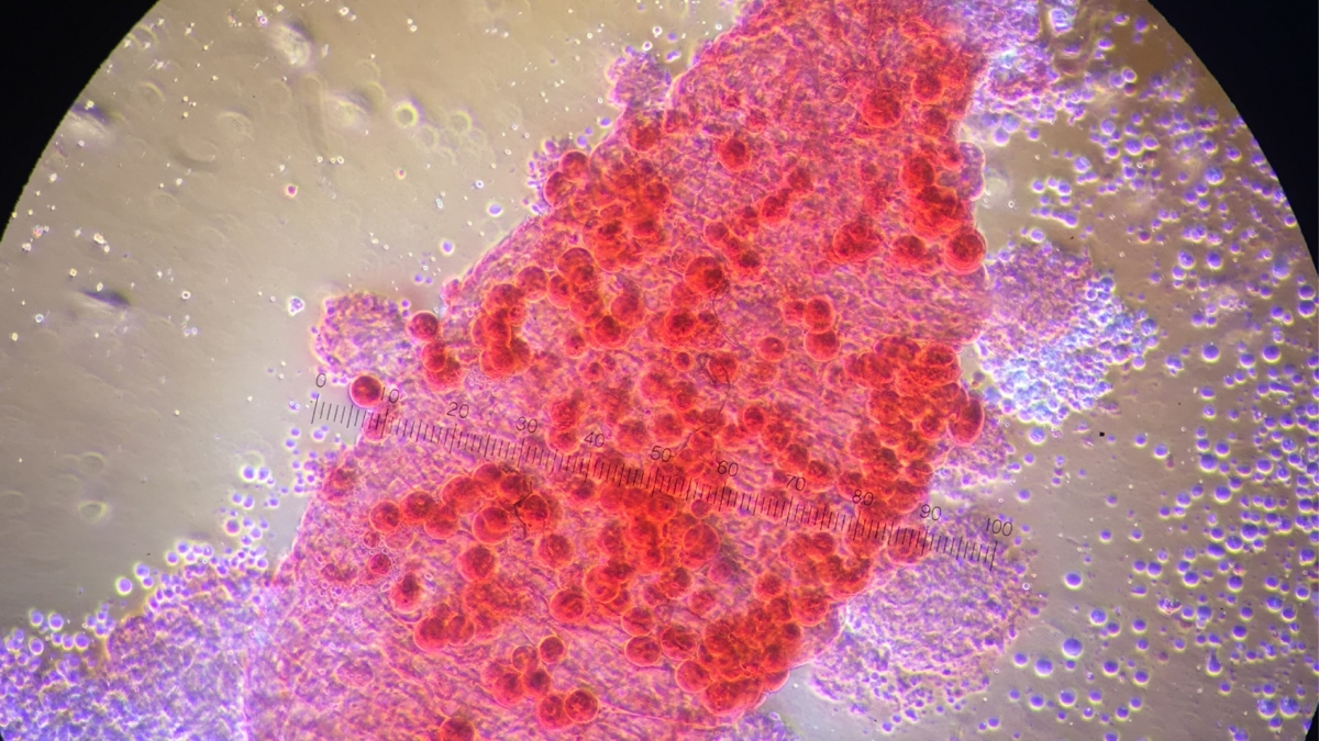 H_Residual-Malaria-003