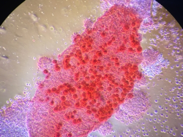 H_Residual-Malaria-003