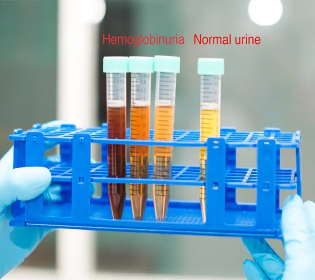 Research_are_G6PD
