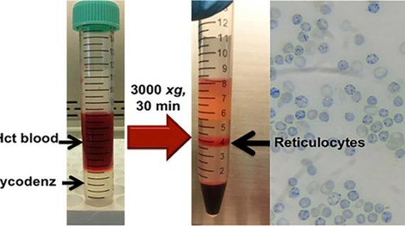 Resources_reticulocyte_